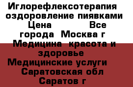 Иглорефлексотерапия, оздоровление пиявками › Цена ­ 3 000 - Все города, Москва г. Медицина, красота и здоровье » Медицинские услуги   . Саратовская обл.,Саратов г.